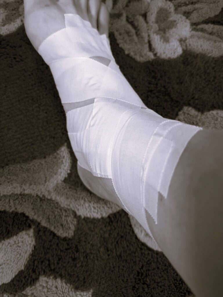 Jordan's ankle taped with rigid sports-tape to enable early, safe return to training.