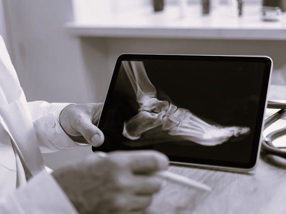 A healthcare professional holds up an x-ray of an ankle. Imaging can be important in assement and planning treatment.